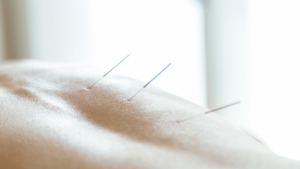 tetik nokta enjeksiyonu