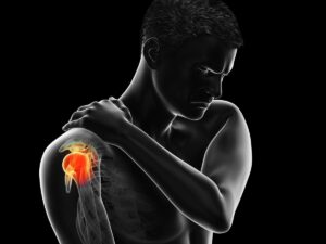 Omuz Sıkışma Sendromu